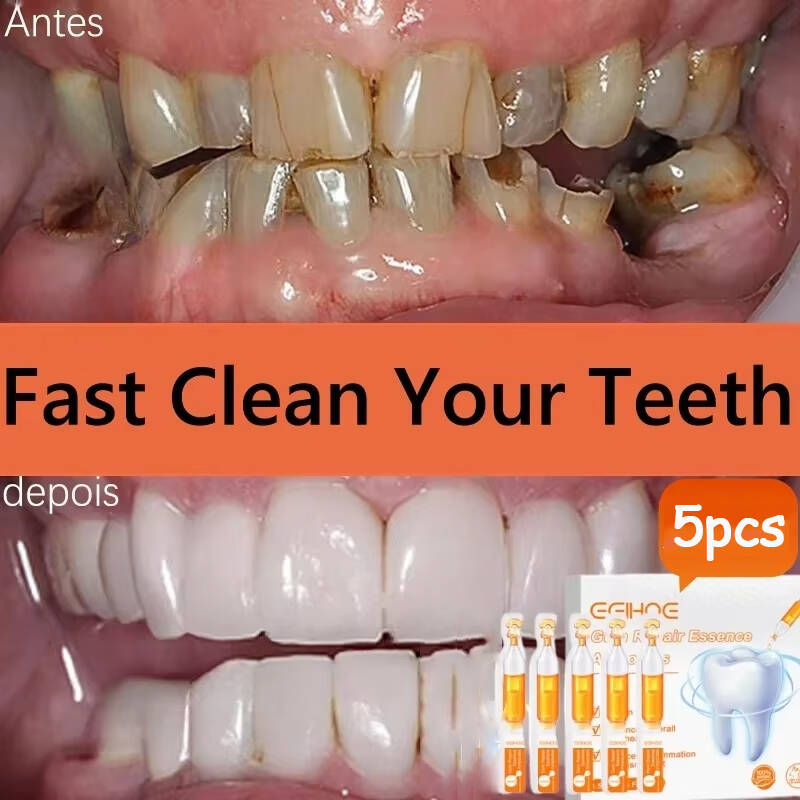 Teeth Whitening With Baking Soda - Quickly Repair Gum Serum Relieve Receding