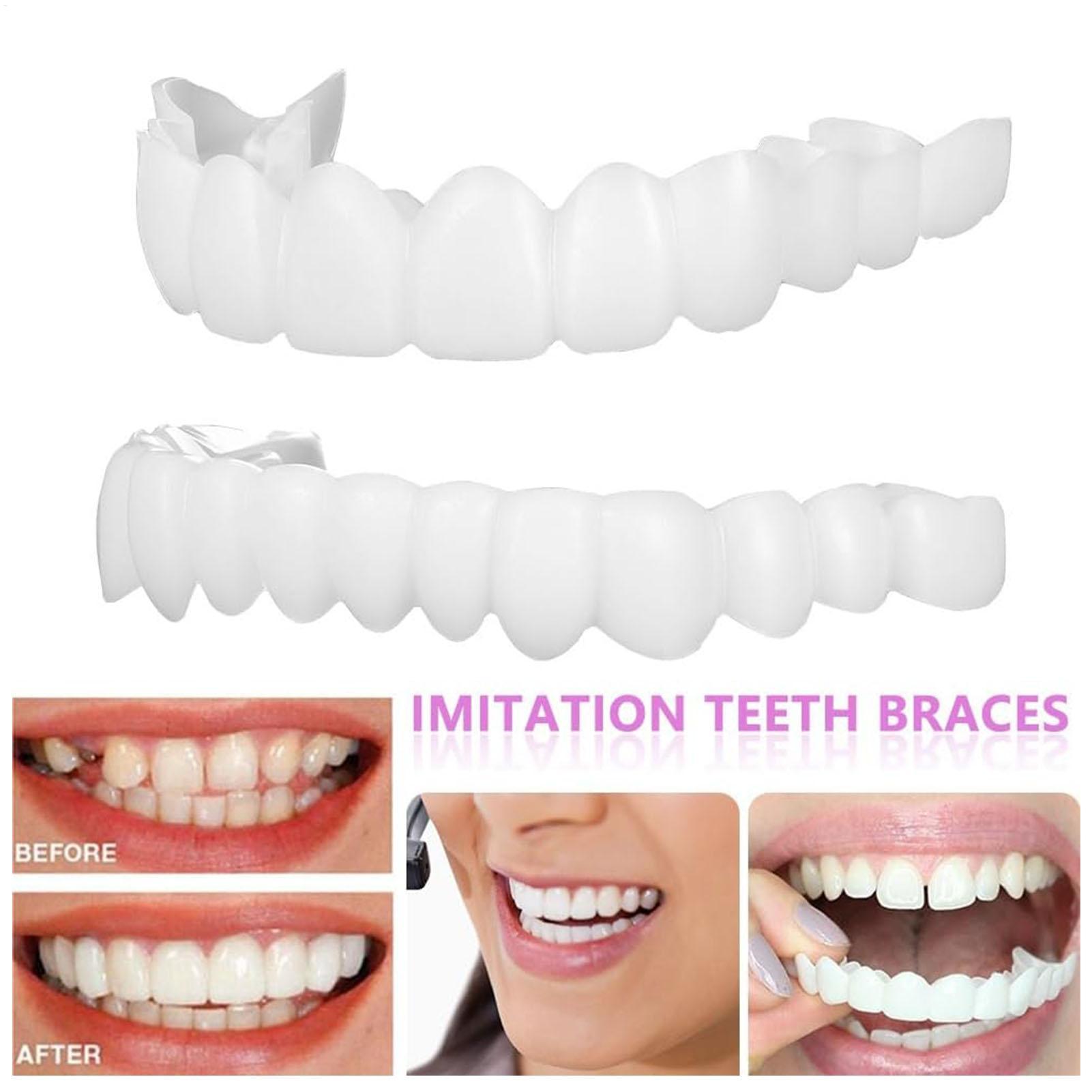 Teeth Whitening With Braces - Dental Upper Lower Fake Teeth Cover