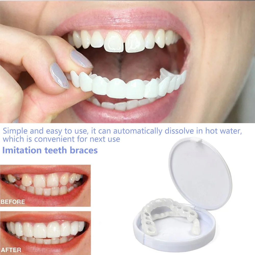 Teeth Whitening With Braces - Sdottor Fake Teeth Artificial Braces Teeth