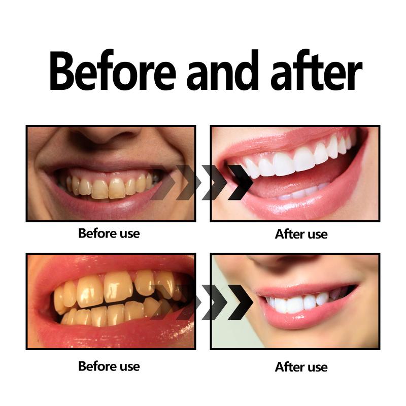 Teeth Whitening Powder Charcoa - Teeth Whitening With Baking Soda review and price