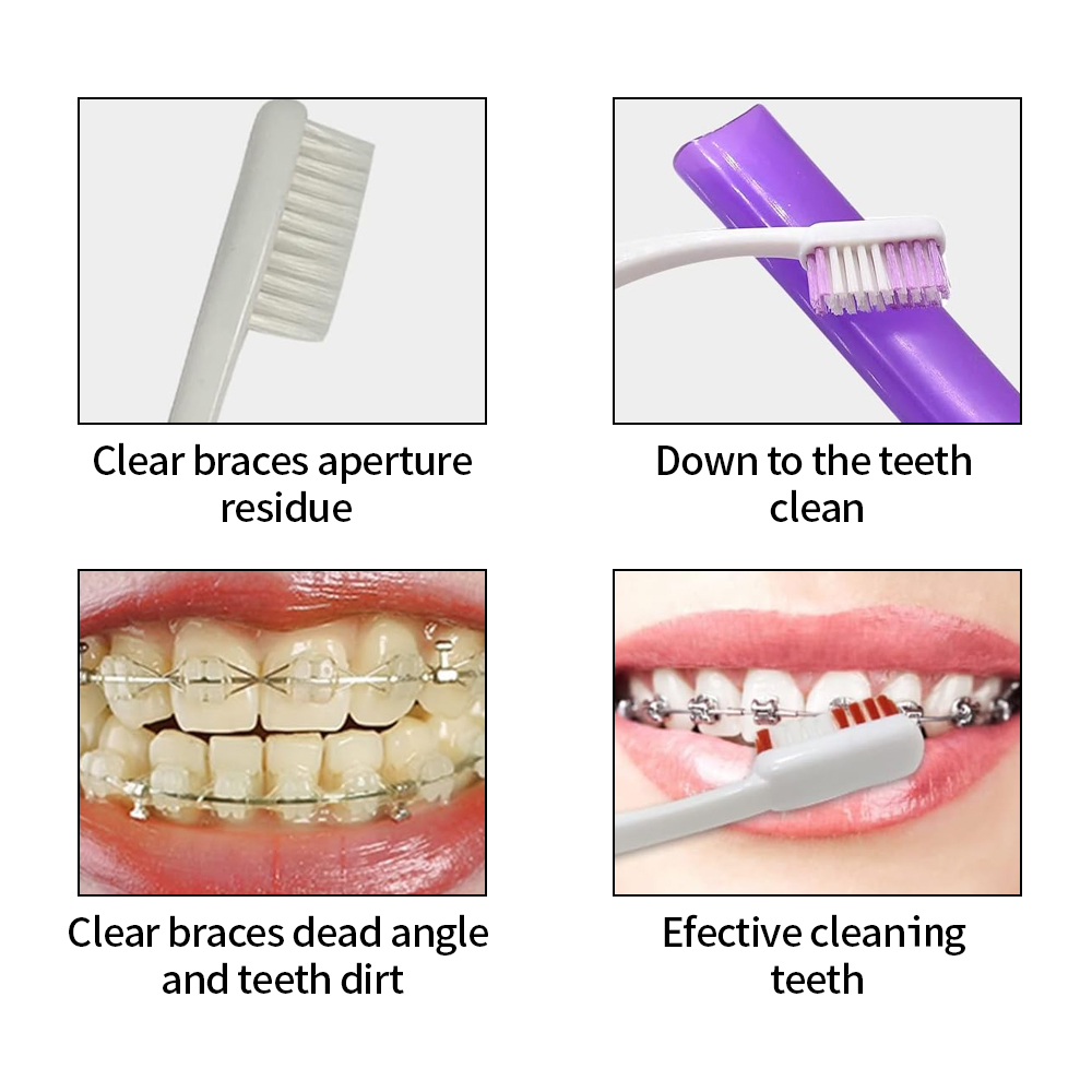 8Pcs/set Orthodontic Dental Ca - Teeth Whitening With Braces review and price