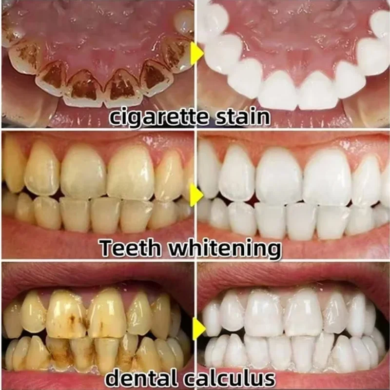 Quickly Repair Gum Serum Relie - Teeth Whitening With Baking Soda review and price