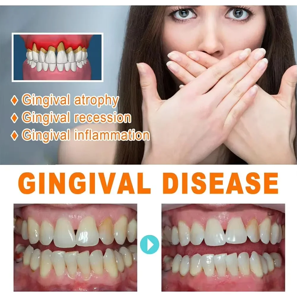 Quickly Repair Gum Serum Relie - Teeth Whitening With Baking Soda review and price