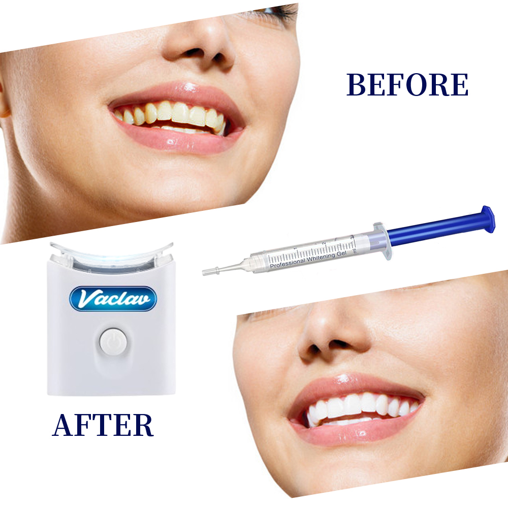 Mint Teeth Whitening Gel Syrin - Teeth Whitening With Baking Soda review and price