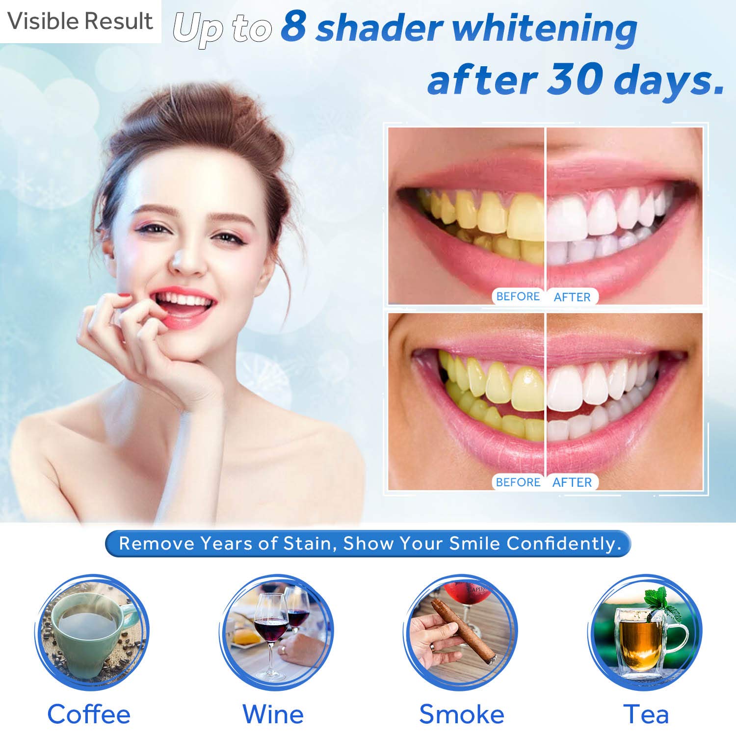 Teeth Whitening Gel Refill Syr - Teeth Whitening Laser review and price