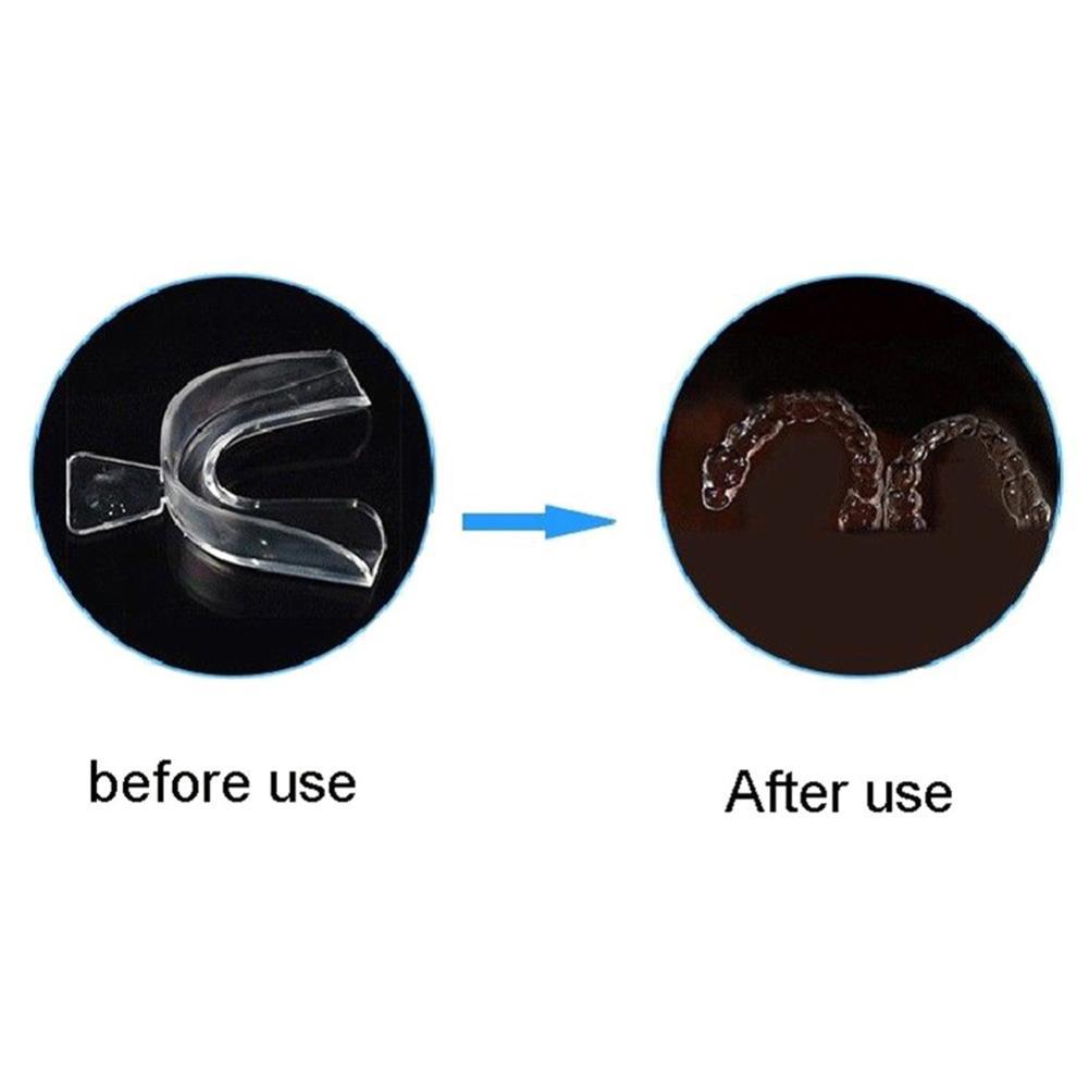 Silicone Mouth Guard Orthodont - Teeth Whitening With Braces review and price