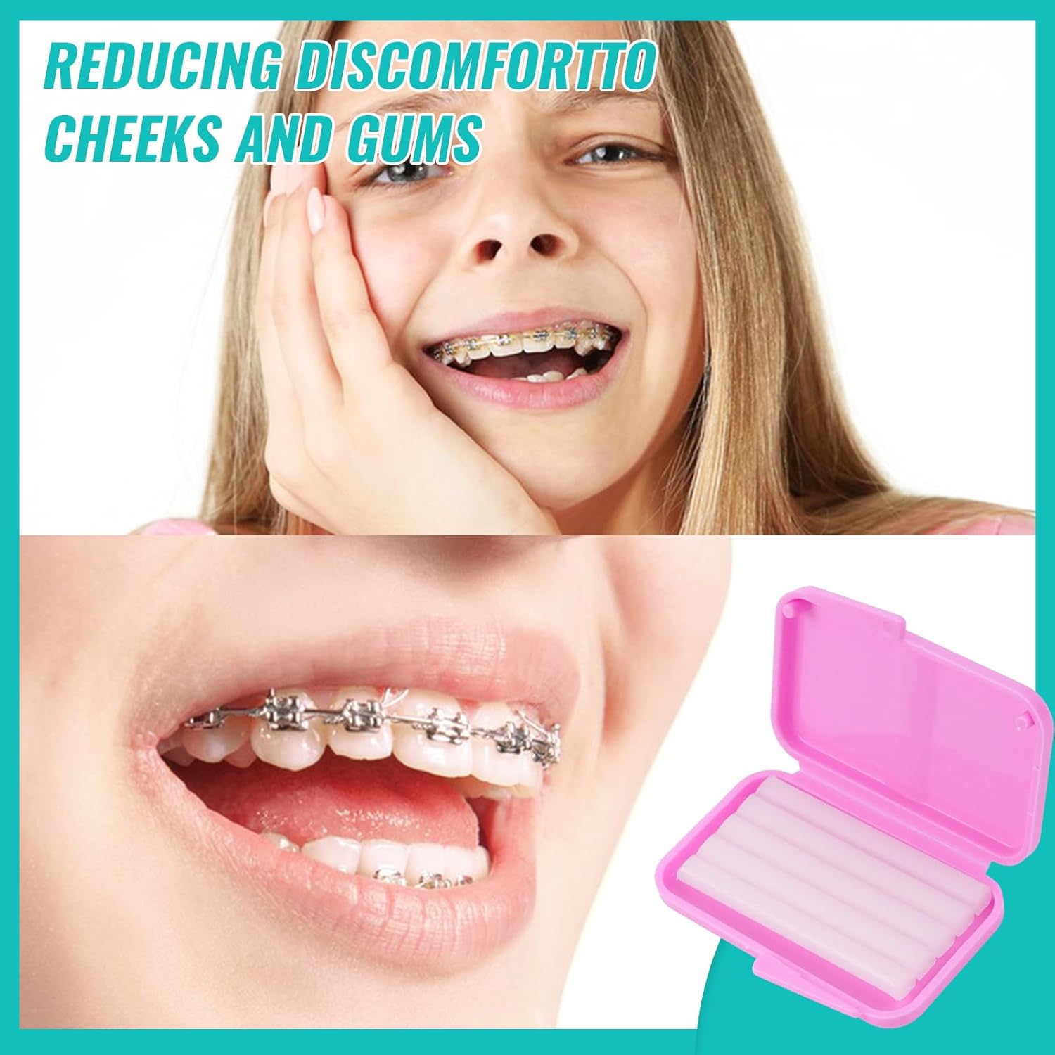 10box Dental Orthodontic Relie - Teeth Whitening With Braces review and price